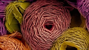 Scanning electron microscope (SEM) image of vaterite